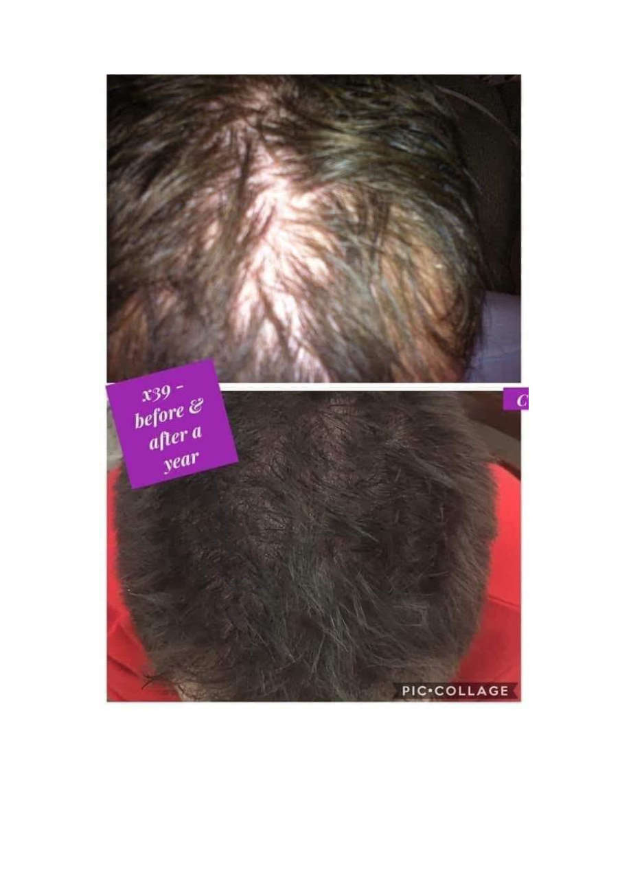 Strona 4 – Fototerapia Ogrody Spa