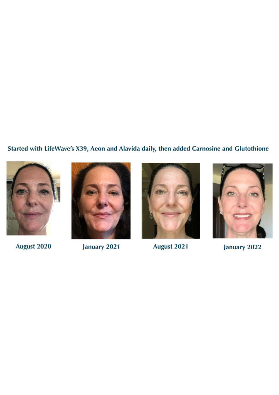 Strona 1 – Fototerapia Ogrody Spa