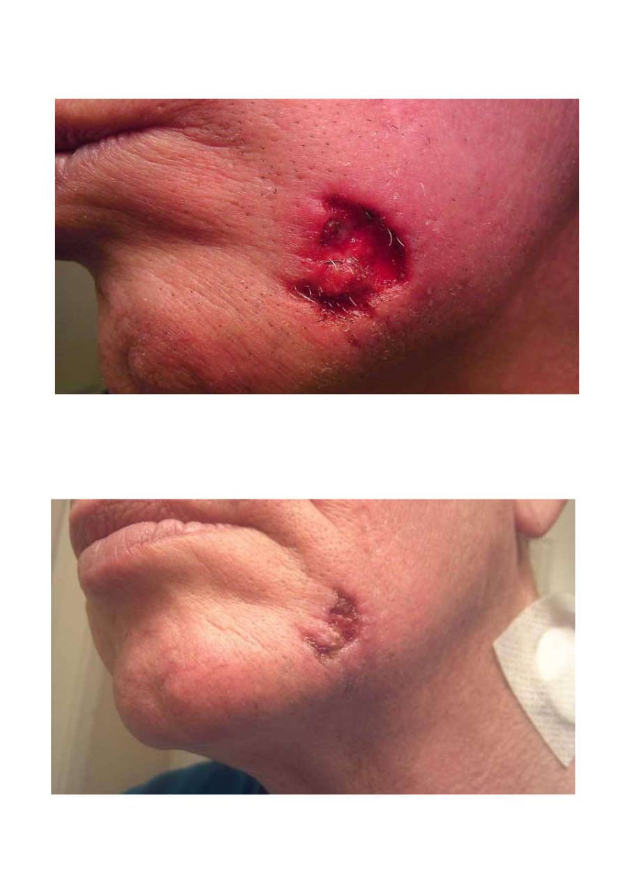 Strona 10 – Fototerapia Ogrody Spa