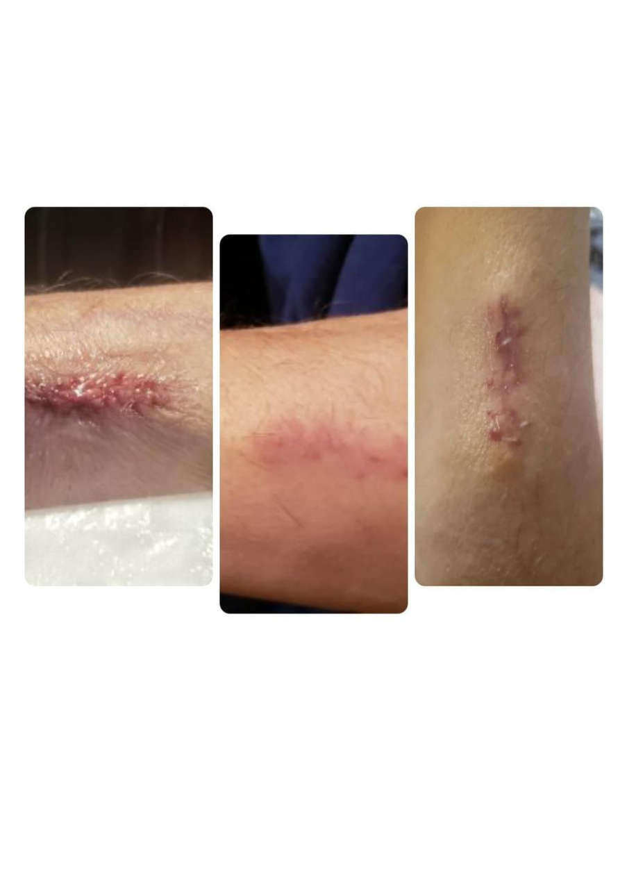 Strona 2 – Fototerapia Ogrody Spa