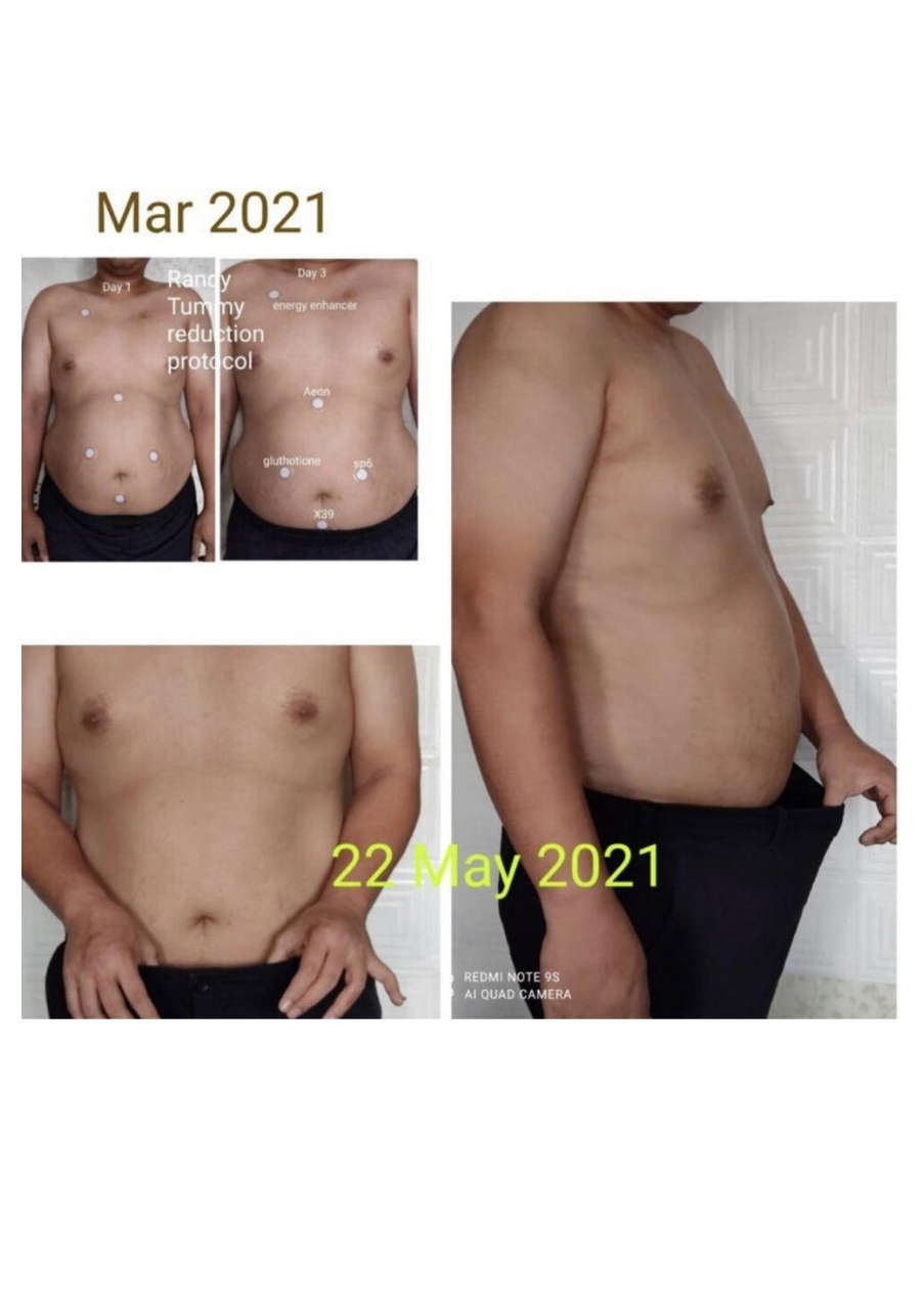 Strona 5 – Fototerapia Ogrody Spa