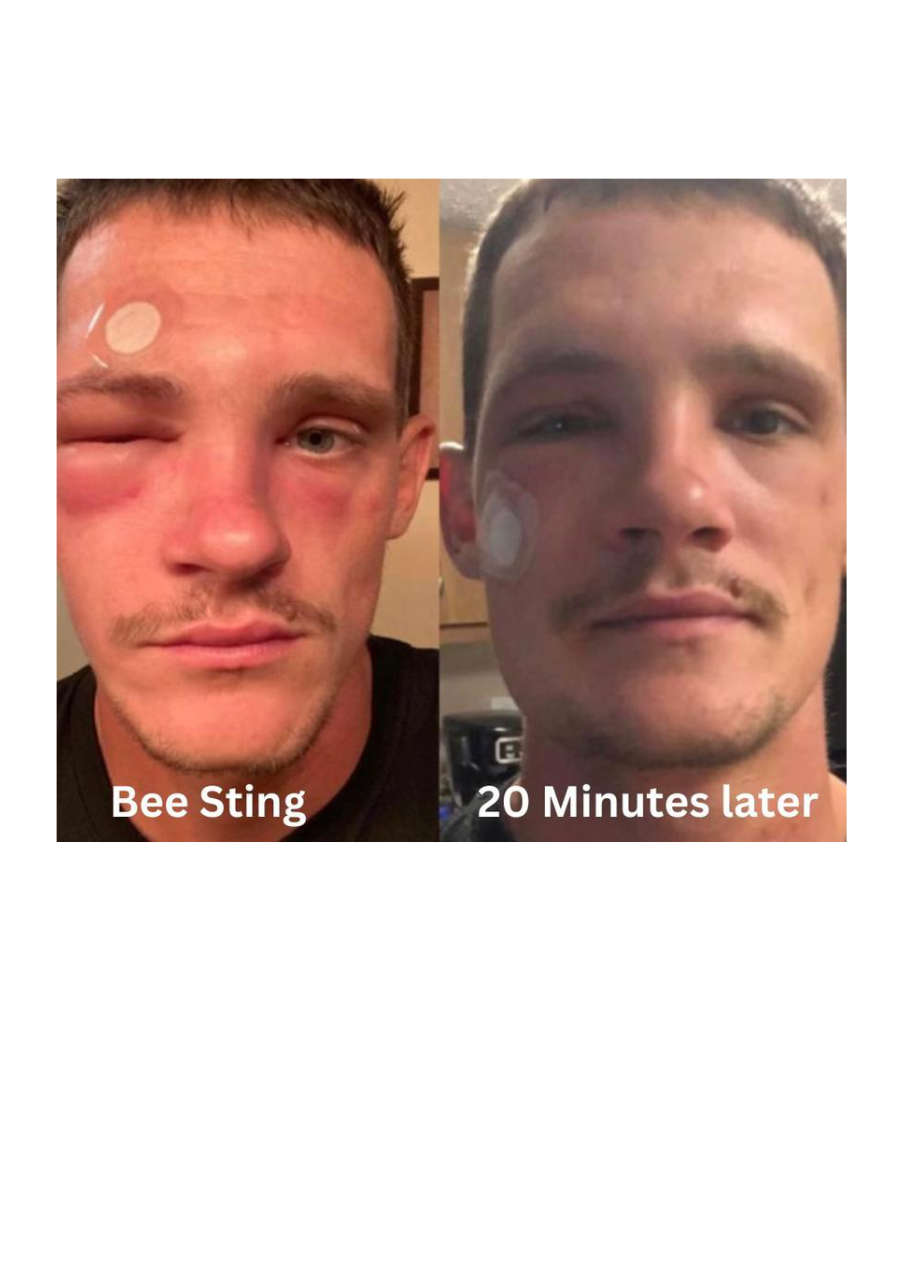 Strona 8 – Fototerapia Ogrody Spa