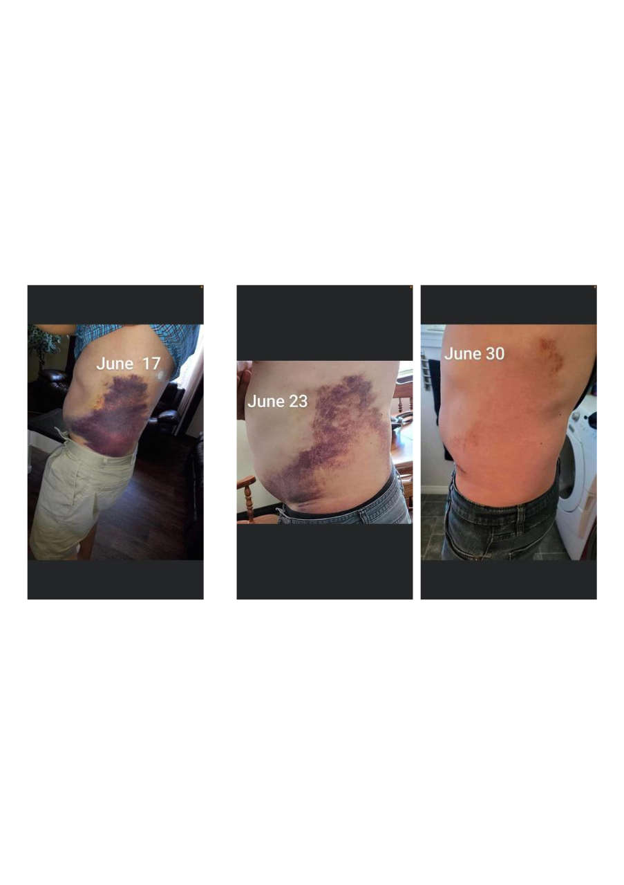 Strona 2 – Fototerapia Ogrody Spa