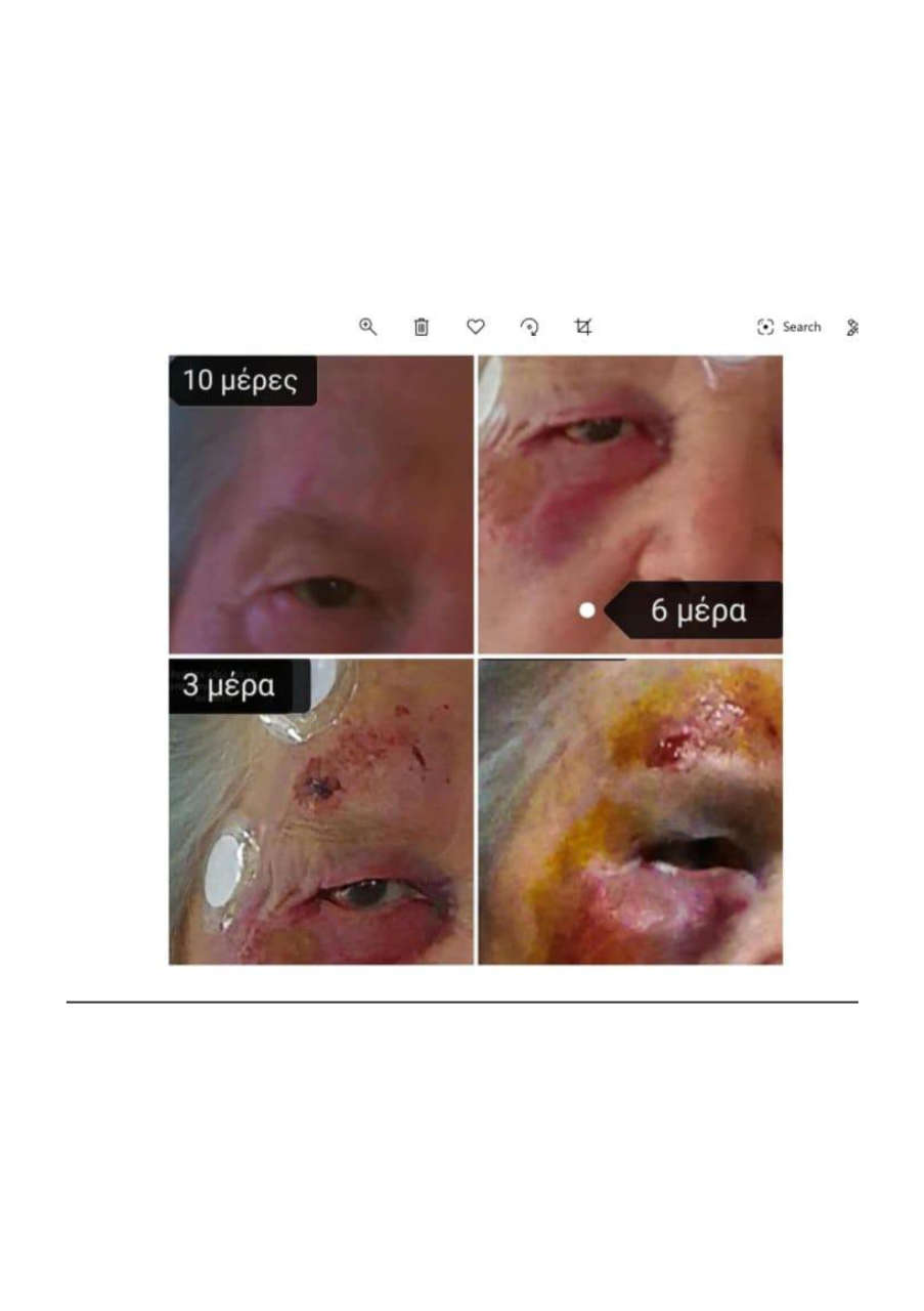 Strona 5 – Fototerapia Ogrody Spa