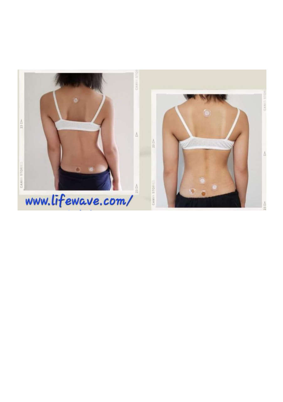 Strona 7 – Fototerapia Ogrody Spa