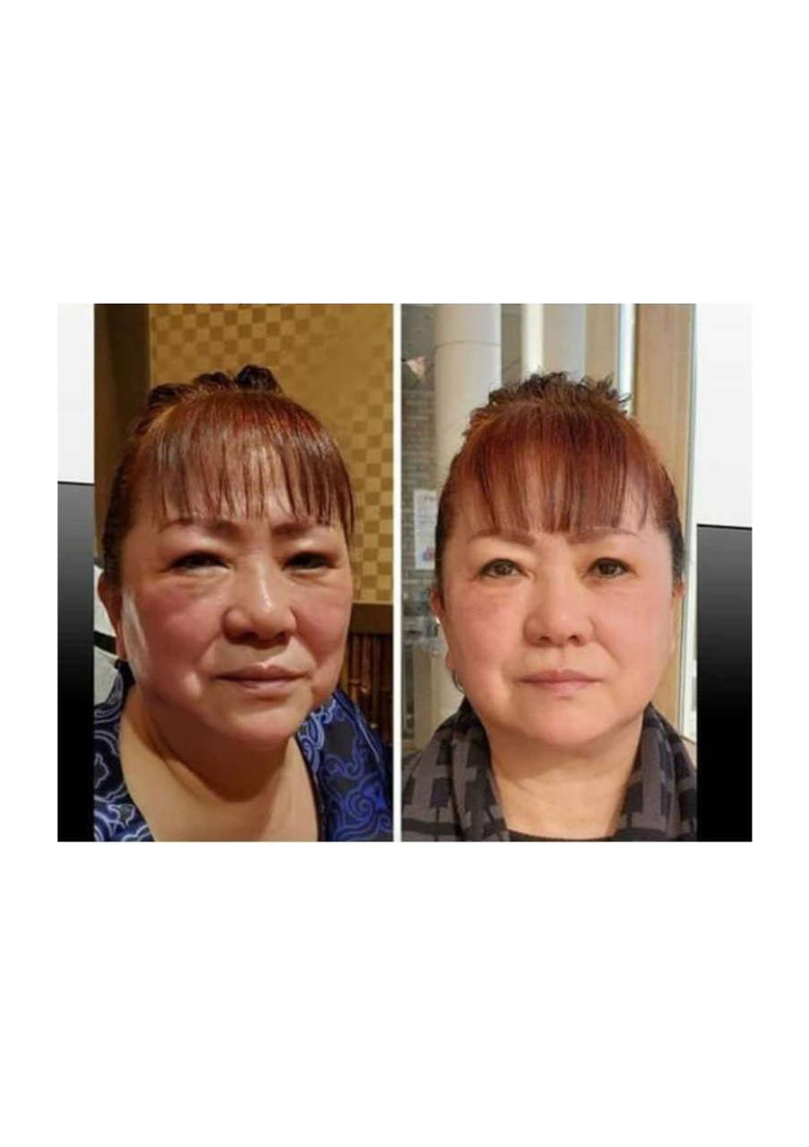 Strona 4 – Fototerapia Ogrody Spa