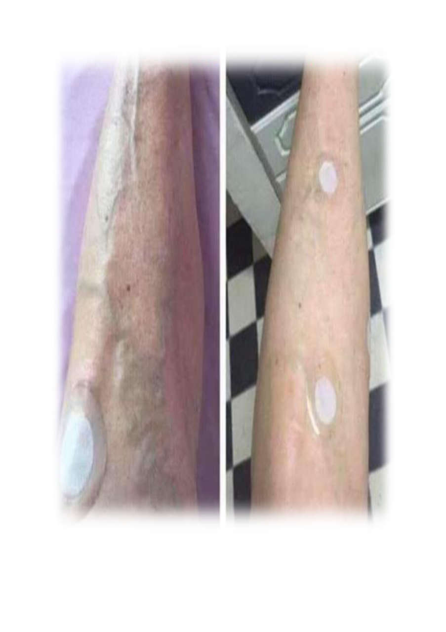 Strona 10 – Fototerapia Ogrody Spa