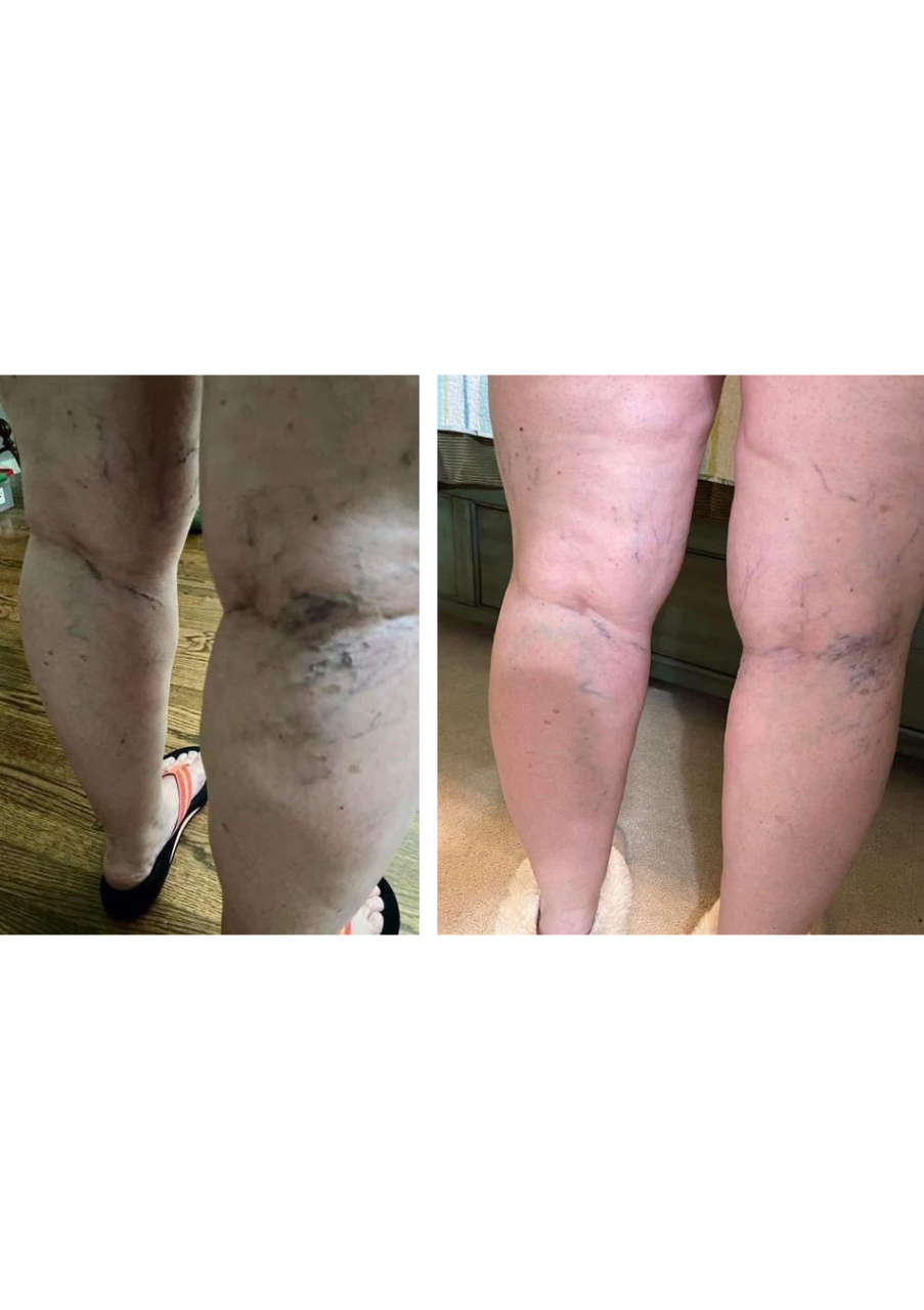 Strona 2 – Fototerapia Ogrody Spa