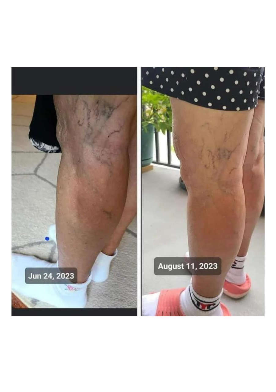 Strona 4 – Fototerapia Ogrody Spa