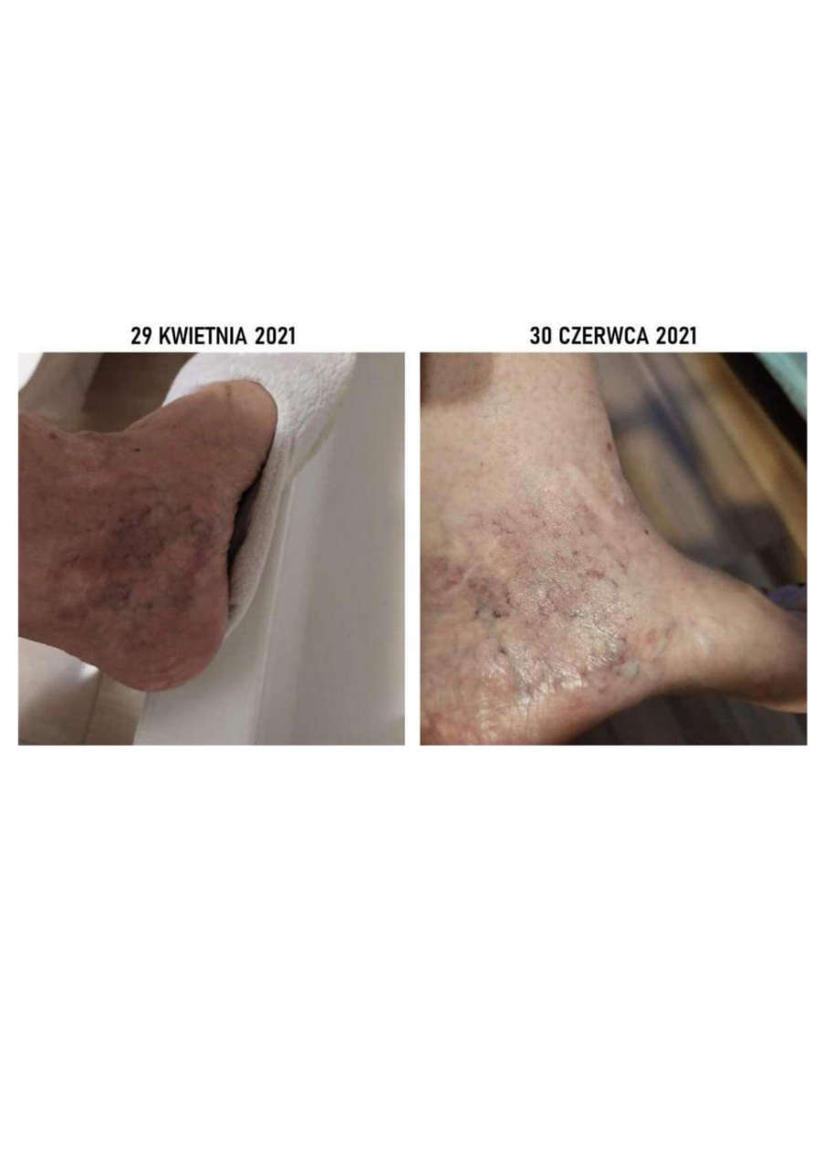 Strona 5 – Fototerapia Ogrody Spa