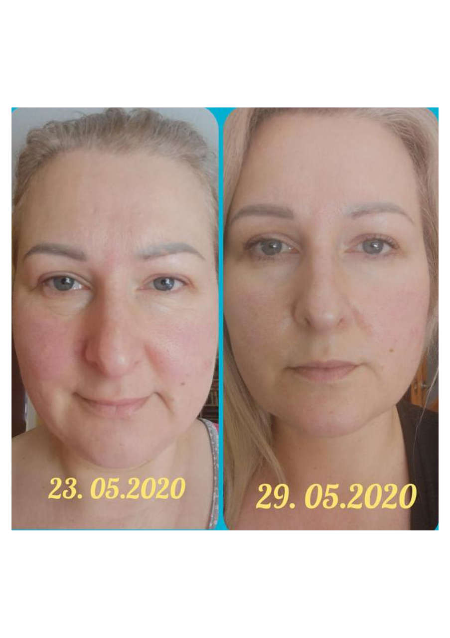 Strona 5 – Fototerapia Ogrody Spa