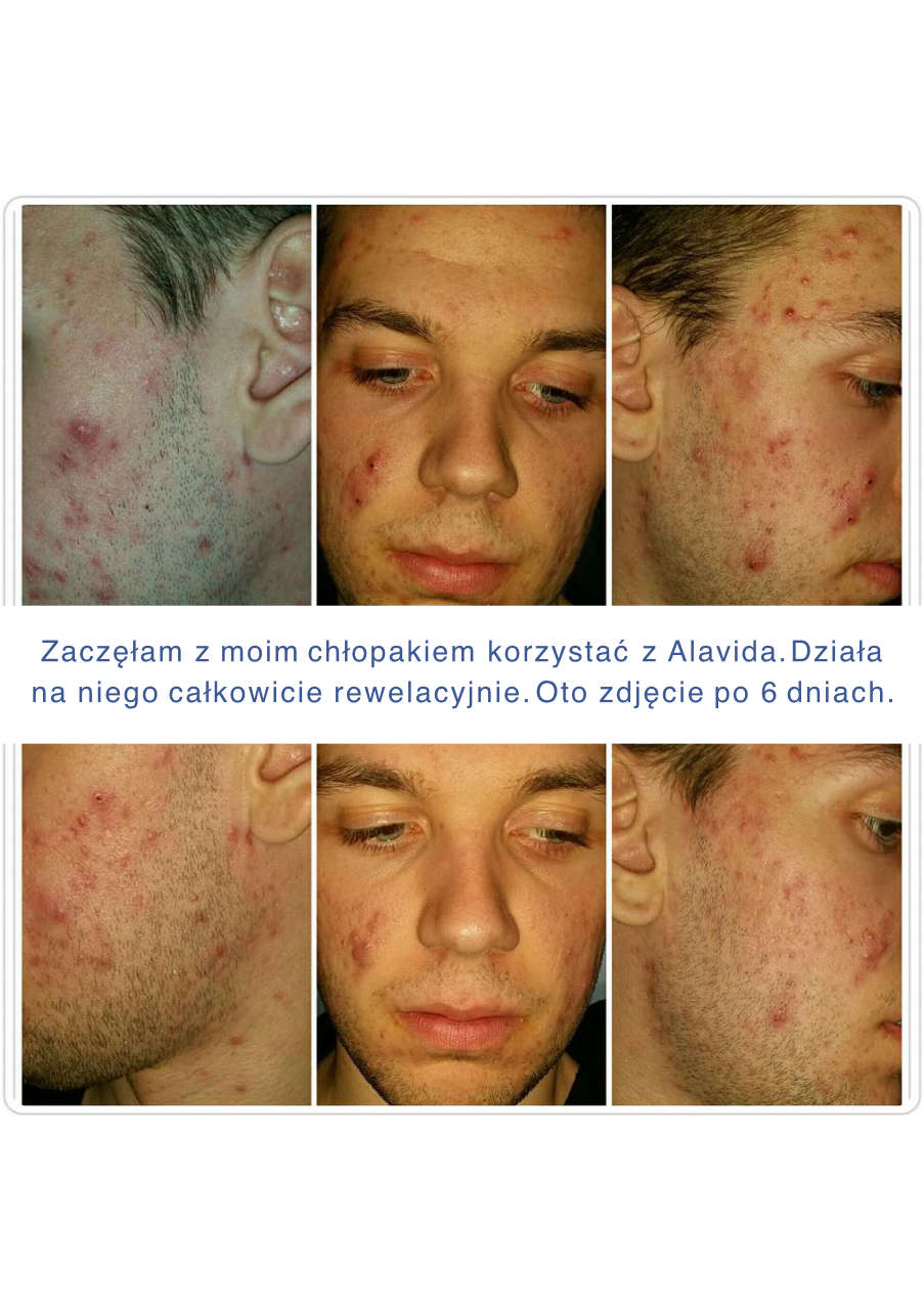 Strona 7 – Fototerapia Ogrody Spa