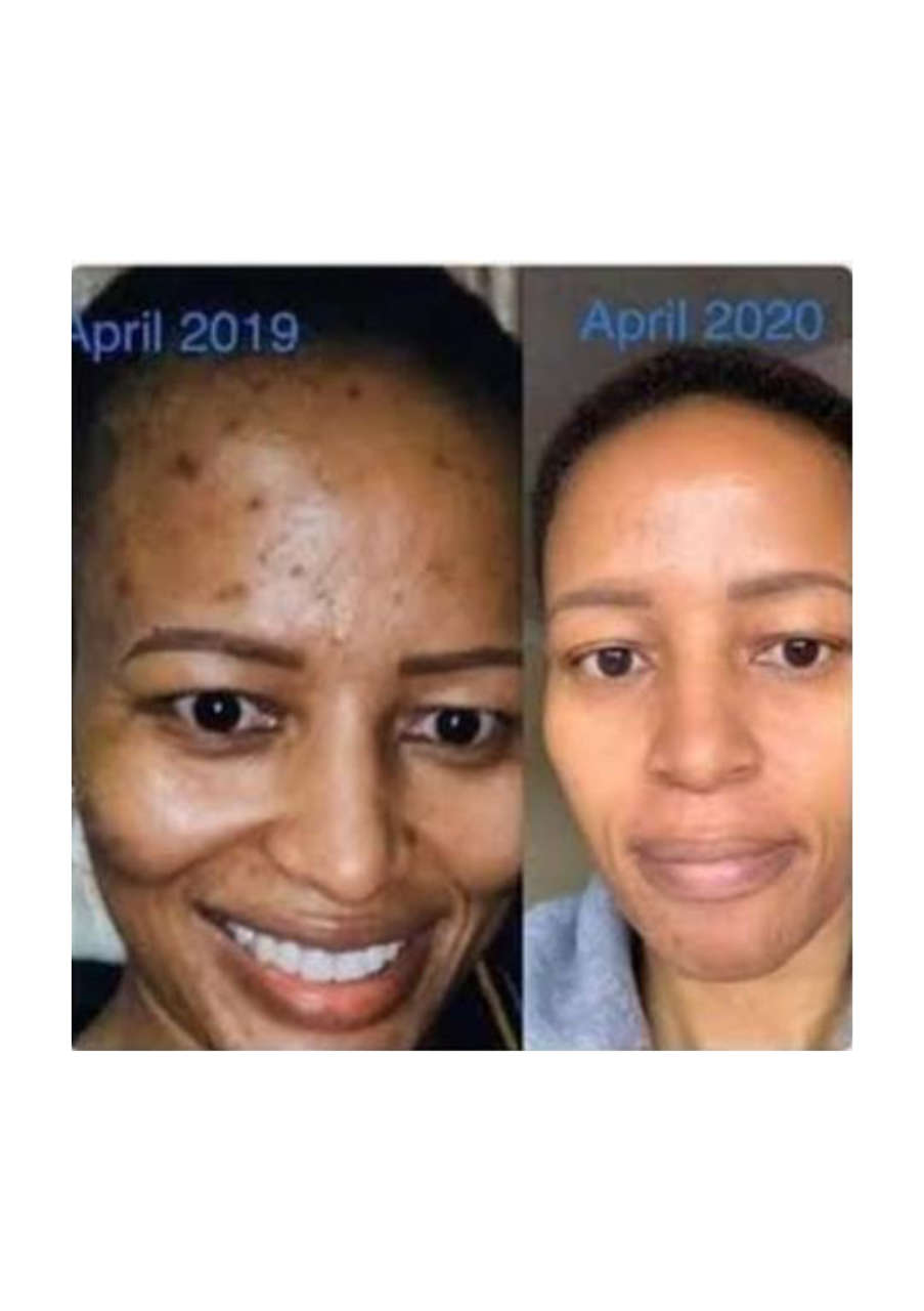 Strona 8 – Fototerapia Ogrody Spa