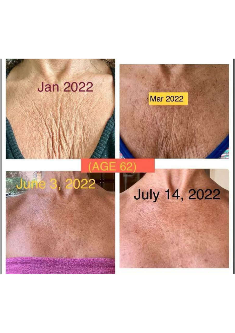 Strona 9 – Fototerapia Ogrody Spa