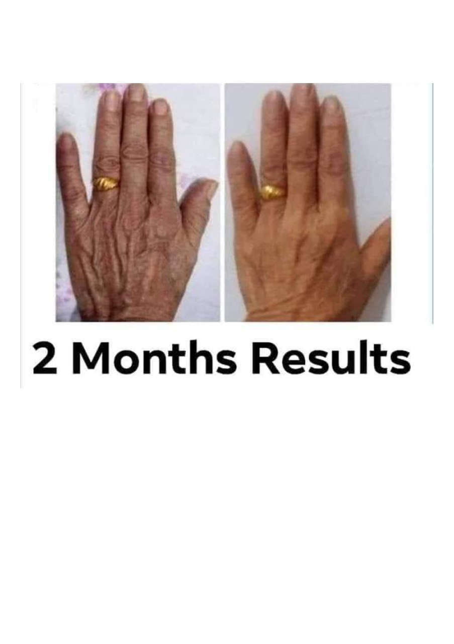 Strona 10 – Fototerapia Ogrody Spa