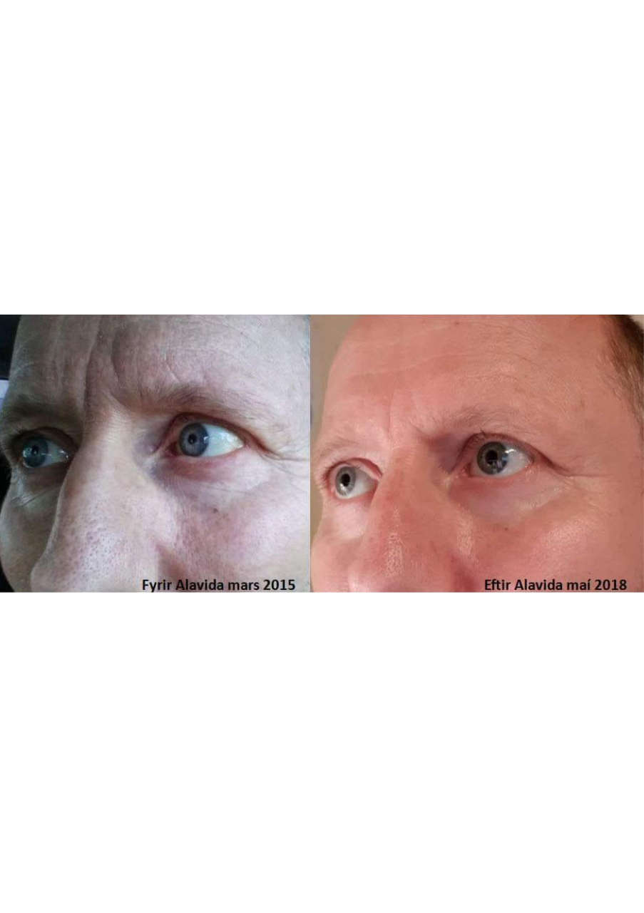 Strona 2 – Fototerapia Ogrody Spa