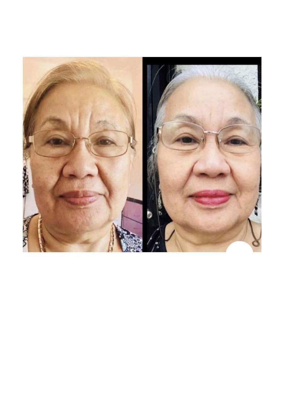 Strona 4 – Fototerapia Ogrody Spa