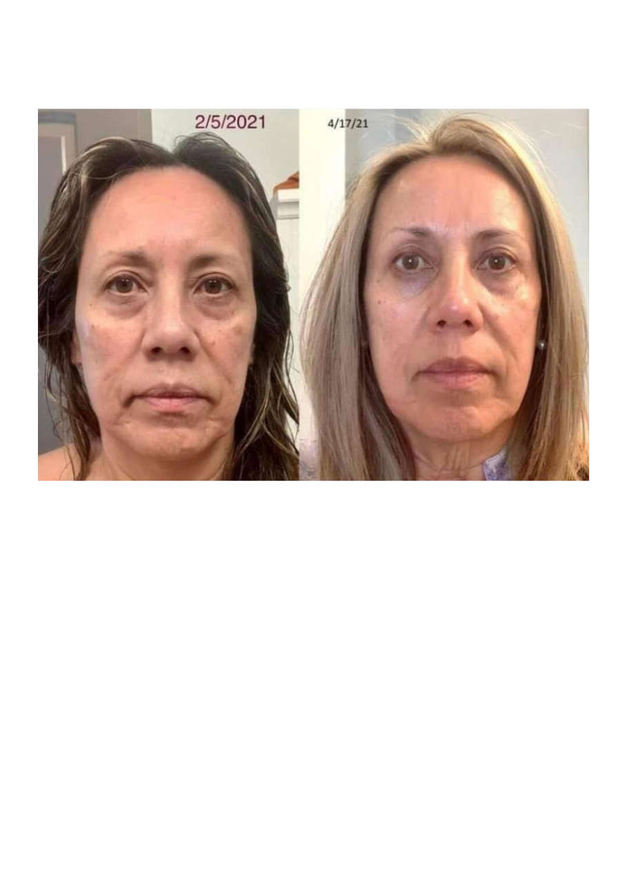 Strona 5 – Fototerapia Ogrody Spa