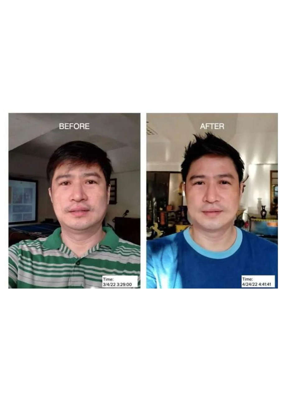 Strona 6 – Fototerapia Ogrody Spa