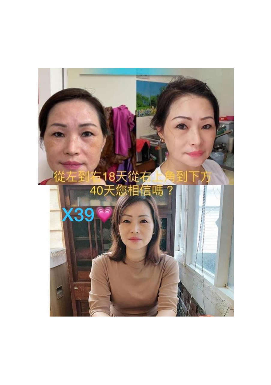 Strona 7 – Fototerapia Ogrody Spa