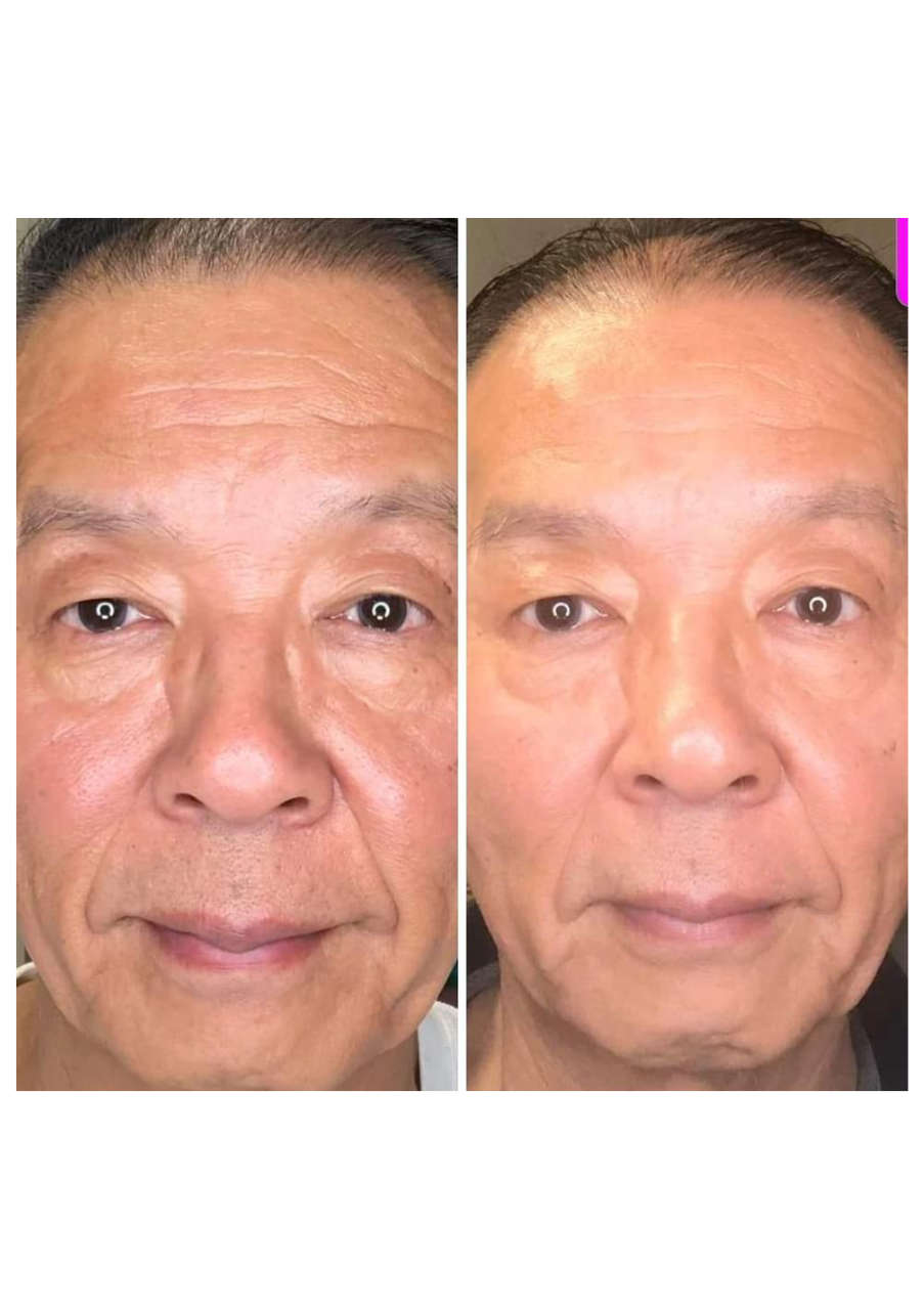 Strona 8 – Fototerapia Ogrody Spa