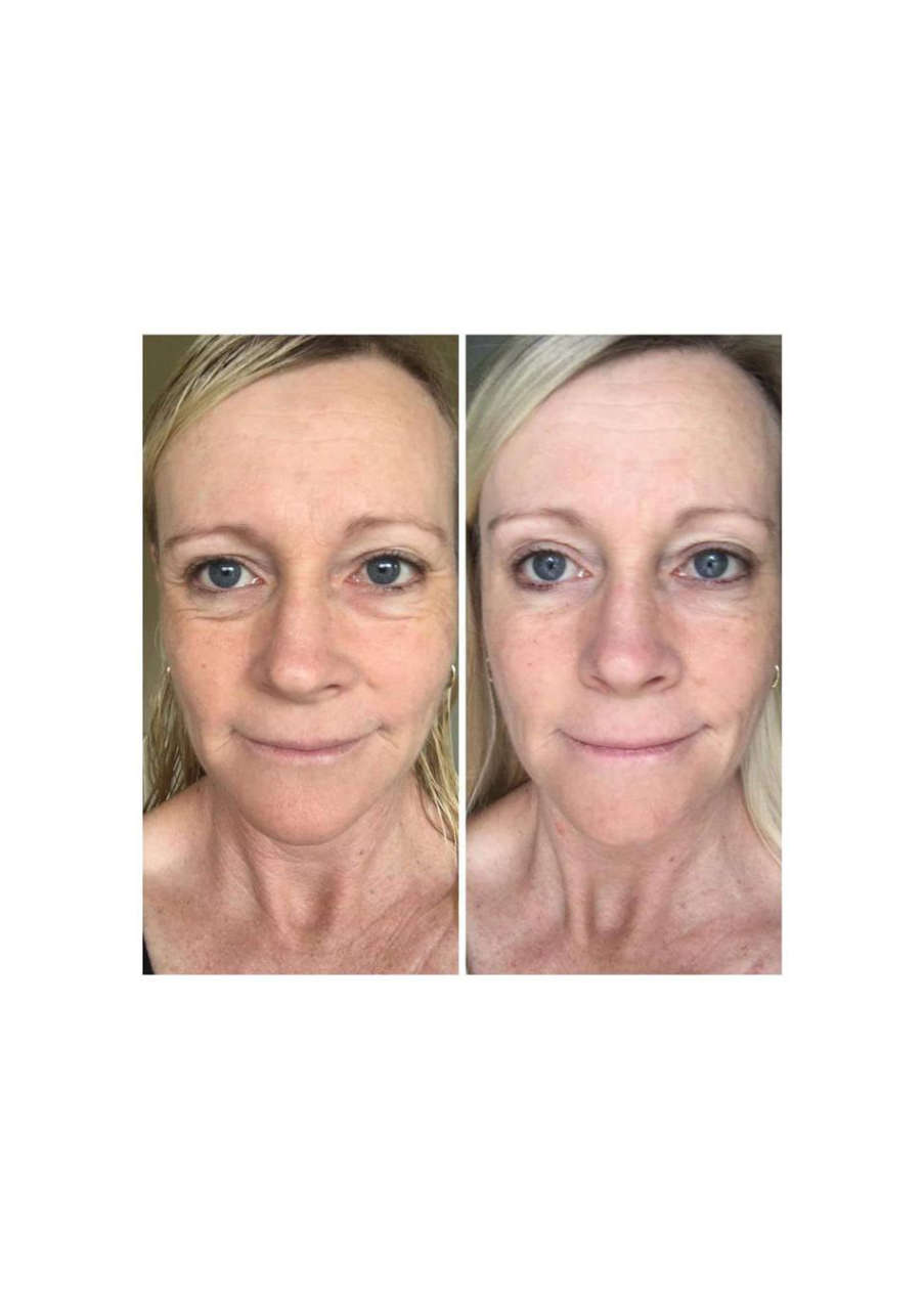 Strona 9 – Fototerapia Ogrody Spa