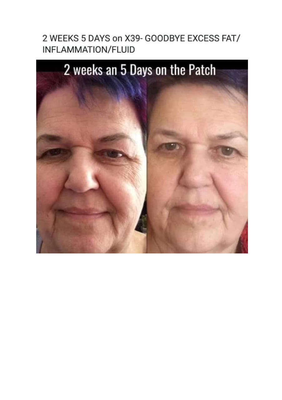 Strona 2 – Fototerapia Ogrody Spa