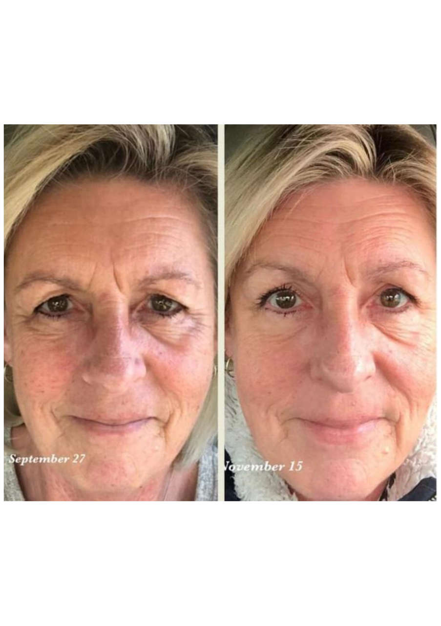 Strona 5 – Fototerapia Ogrody Spa