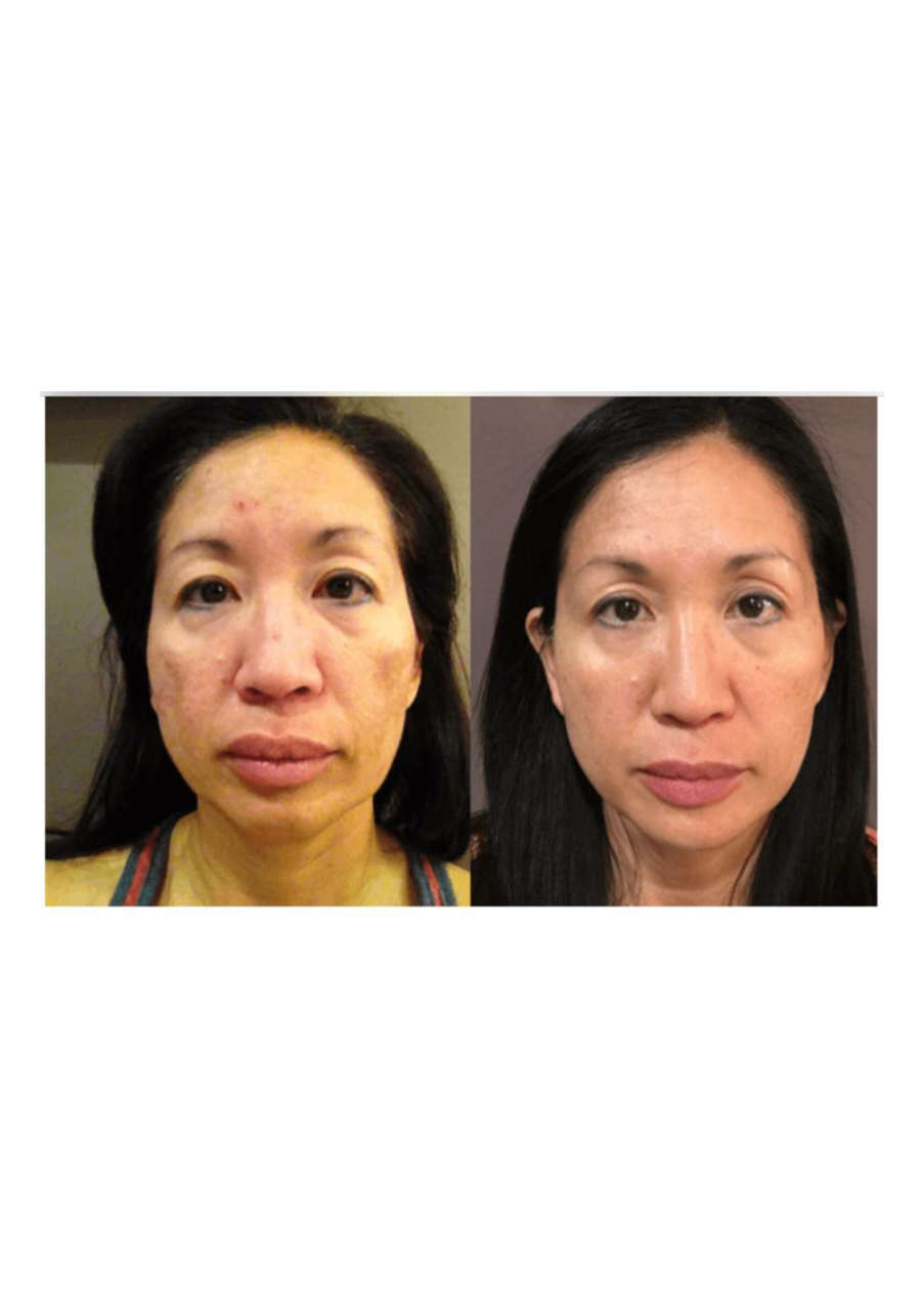 Strona 9 – Fototerapia Ogrody Spa