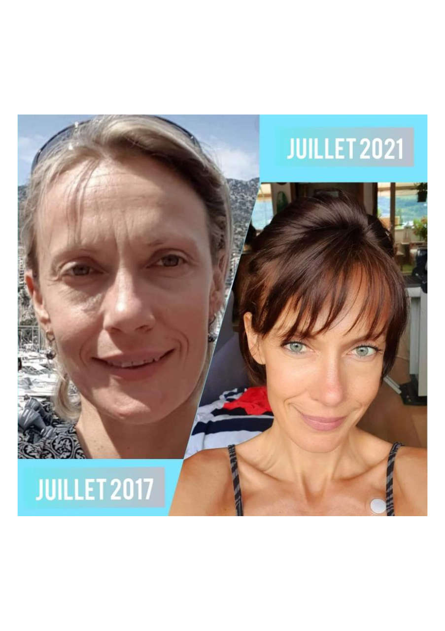 Strona 8 – Fototerapia Ogrody Spa