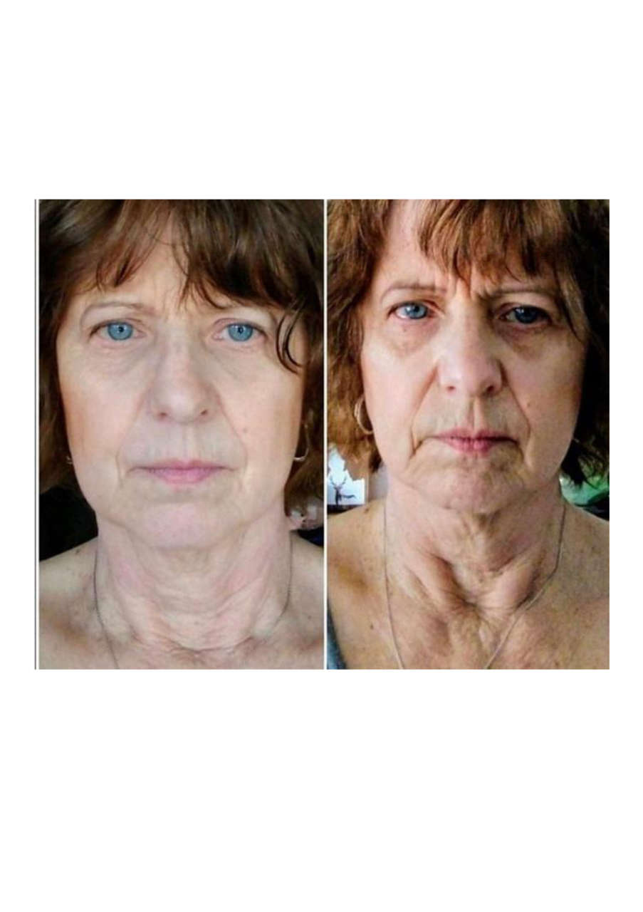 Strona 9 – Fototerapia Ogrody Spa