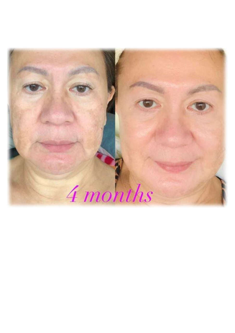 Strona 10 – Fototerapia Ogrody Spa