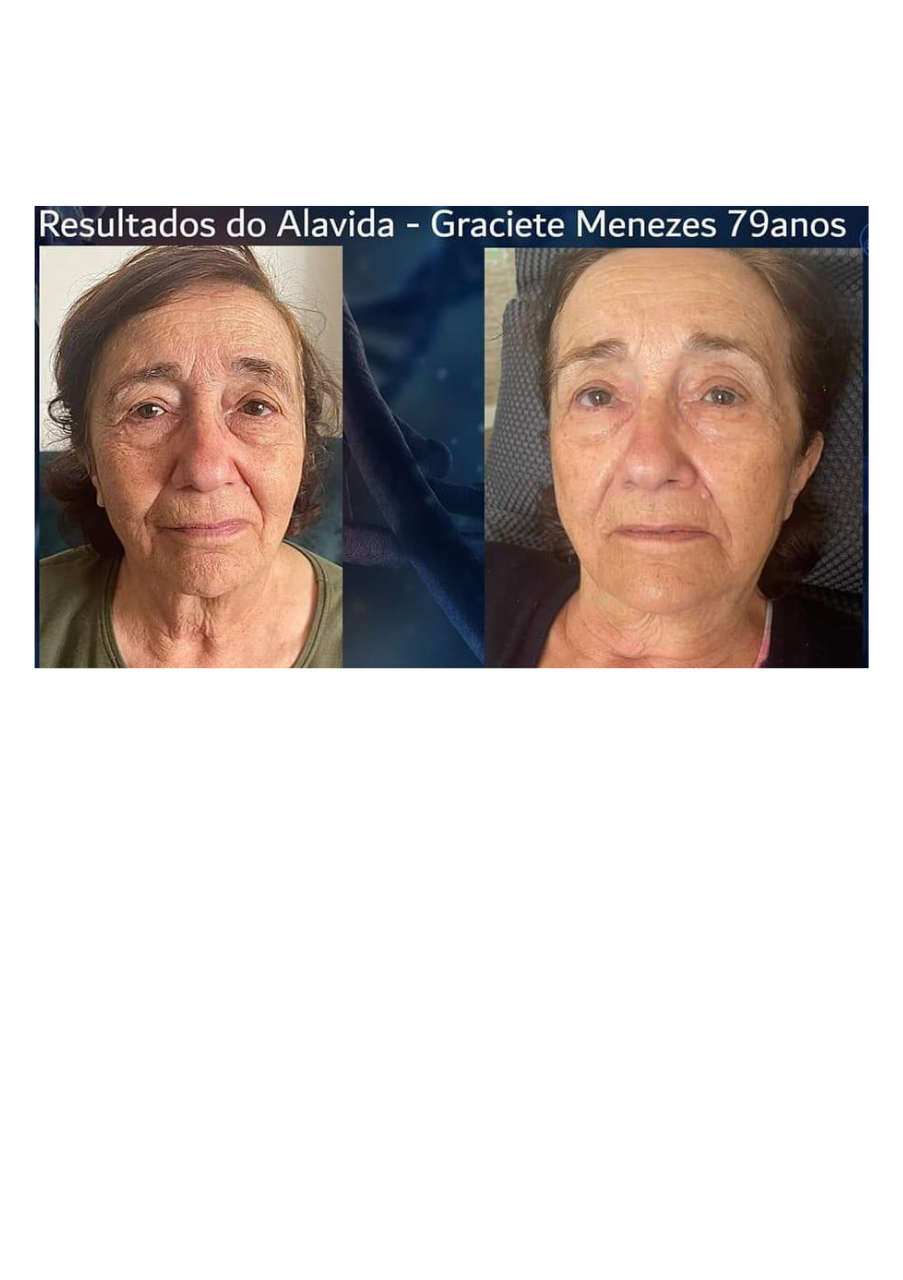 Strona 1 – Fototerapia Ogrody Spa