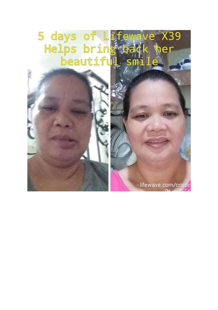 Strona 2 – Fototerapia Ogrody Spa