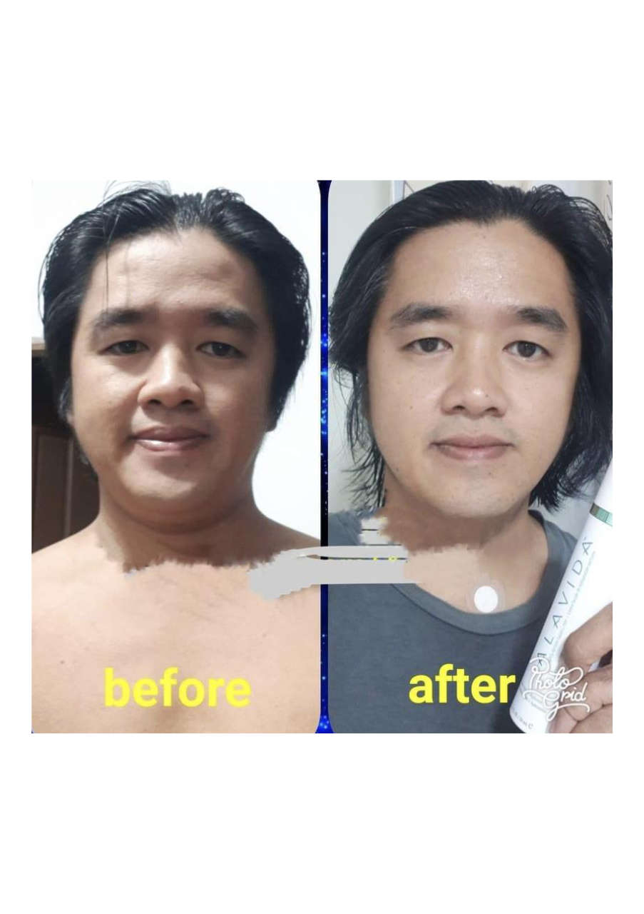 Strona 8 – Fototerapia Ogrody Spa