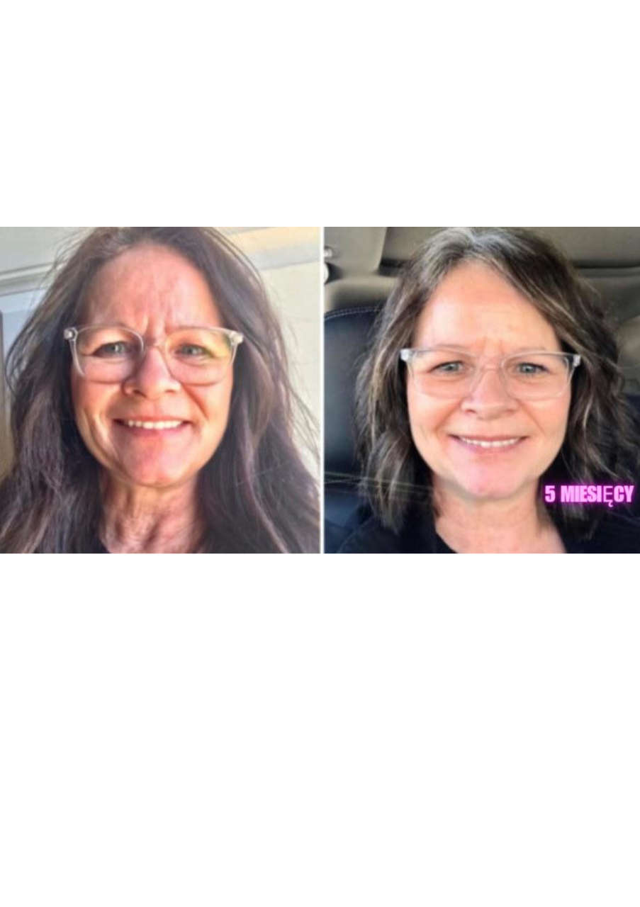 Strona 2 – Fototerapia Ogrody Spa