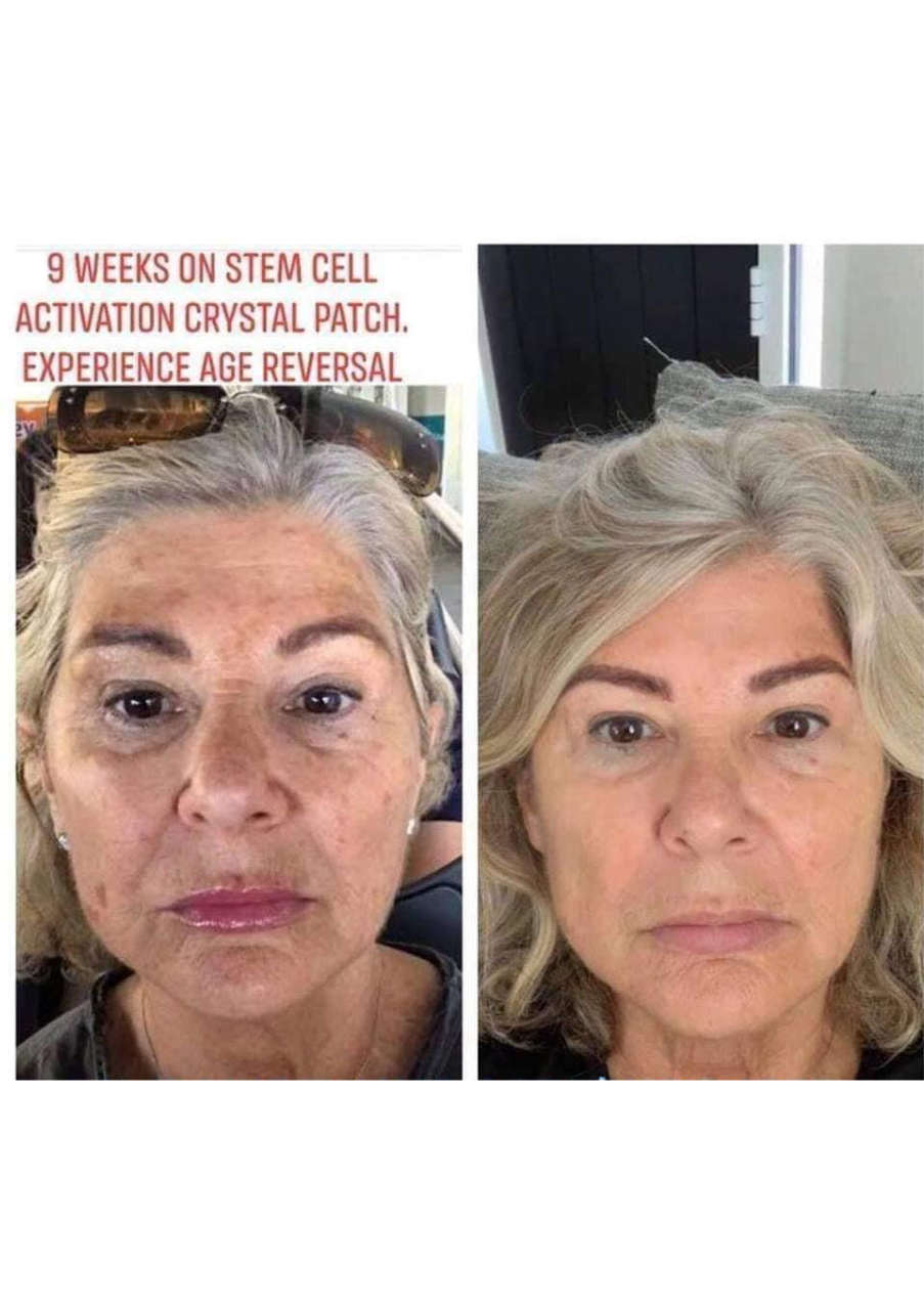 Strona 7 – Fototerapia Ogrody Spa