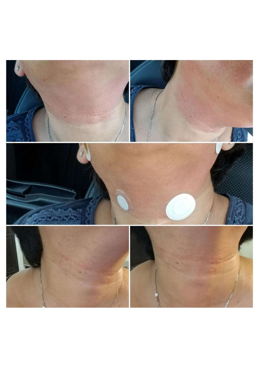 Strona 10 – Fototerapia Ogrody Spa