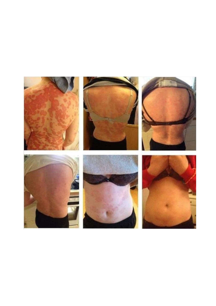 Strona 5 – Fototerapia Ogrody Spa