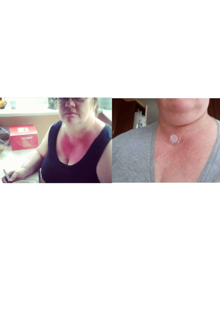 Strona 6 – Fototerapia Ogrody Spa