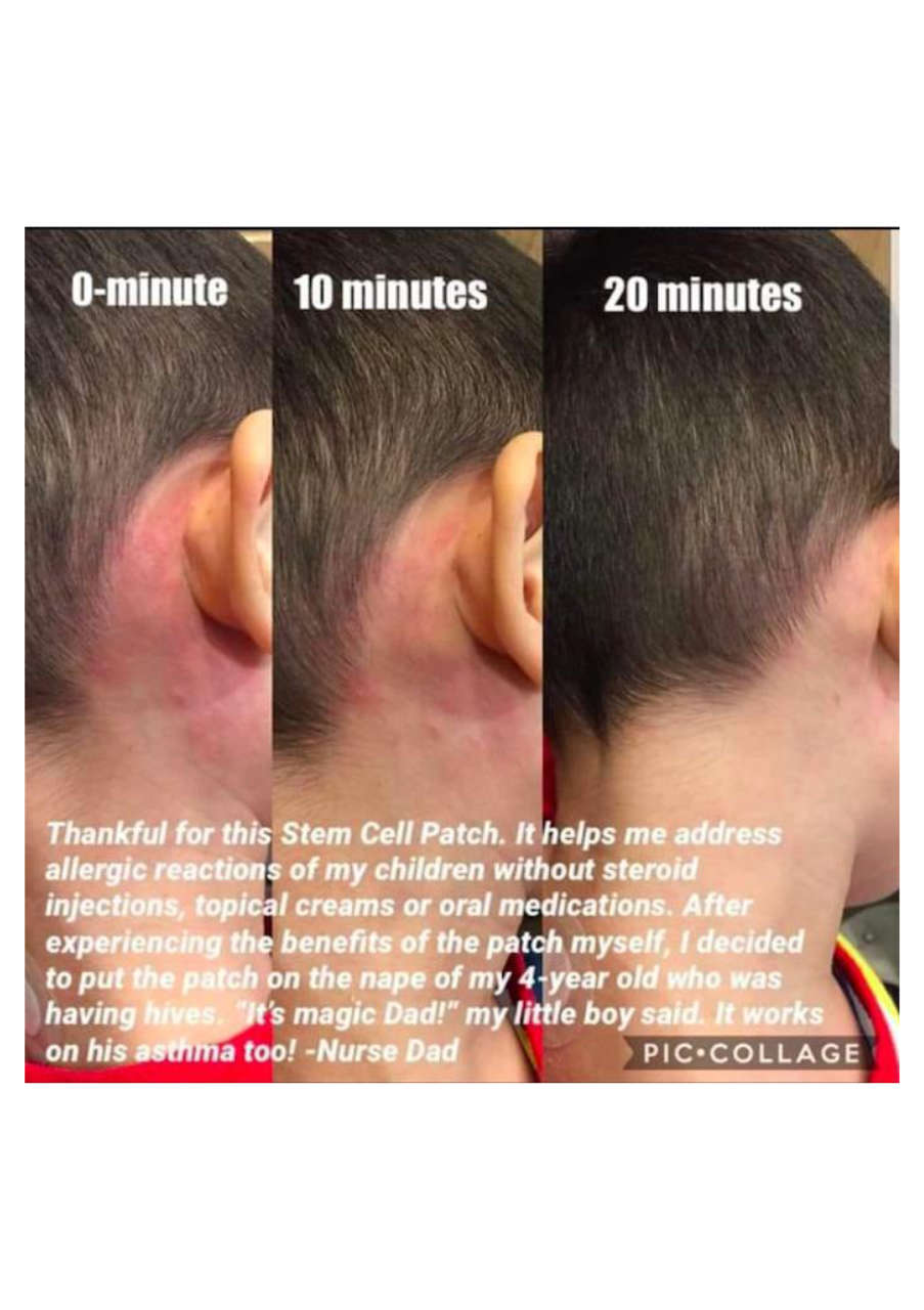 Strona 8 – Fototerapia Ogrody Spa