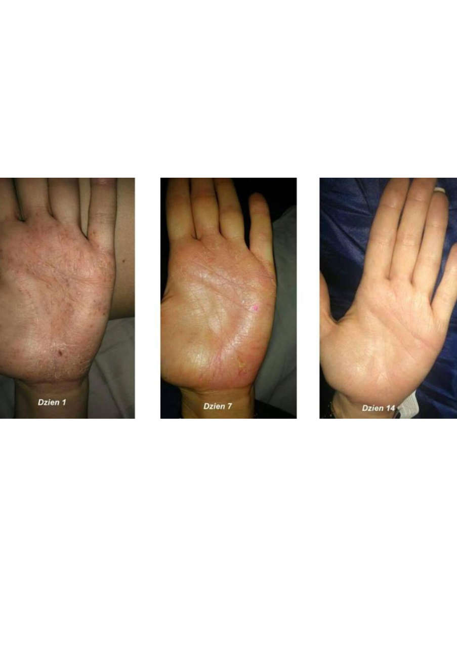 Strona 4 – Fototerapia Ogrody Spa