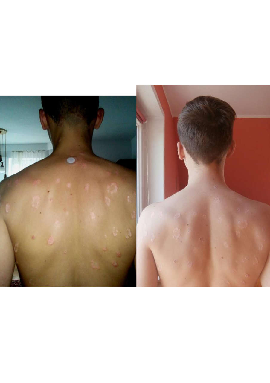 Strona 6 – Fototerapia Ogrody Spa