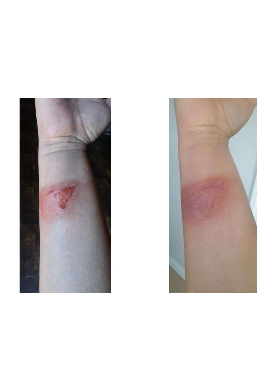 Strona 7 – Fototerapia Ogrody Spa