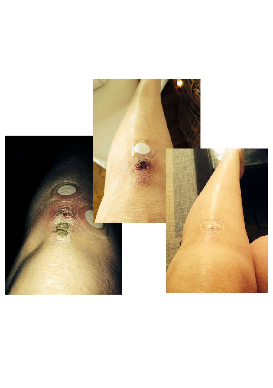 Strona 8 – Fototerapia Ogrody Spa