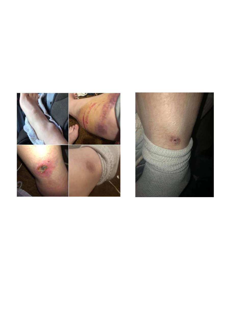 Strona 10 – Fototerapia Ogrody Spa