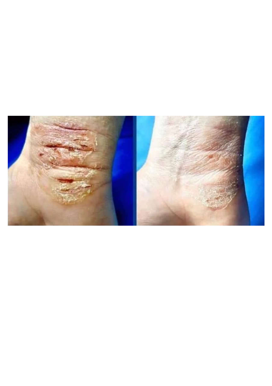 Strona 1 – Fototerapia Ogrody Spa