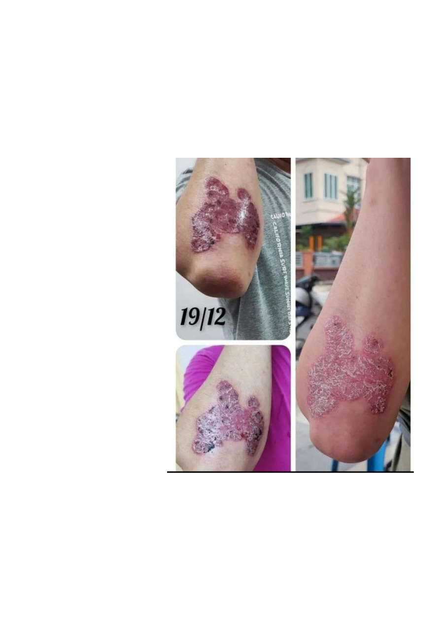 Strona 2 – Fototerapia Ogrody Spa