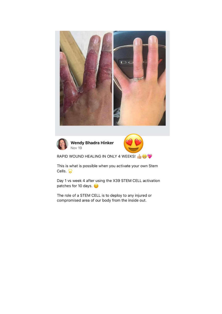 Strona 3 – Fototerapia Ogrody Spa