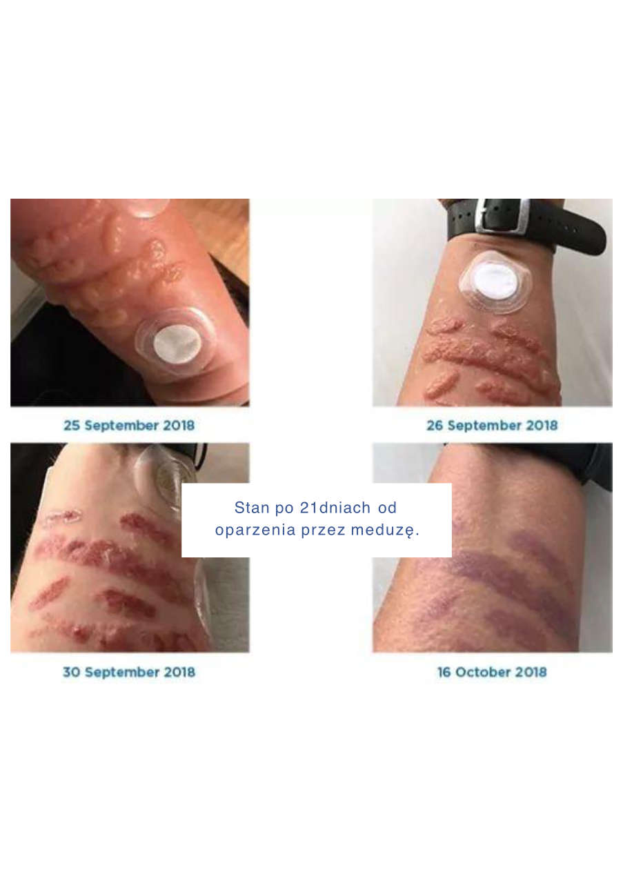 Strona 4 – Fototerapia Ogrody Spa